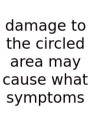 Damage To The Circled Area May Cause What Symptoms